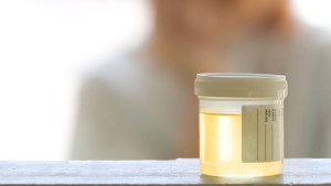Drug Testing urine